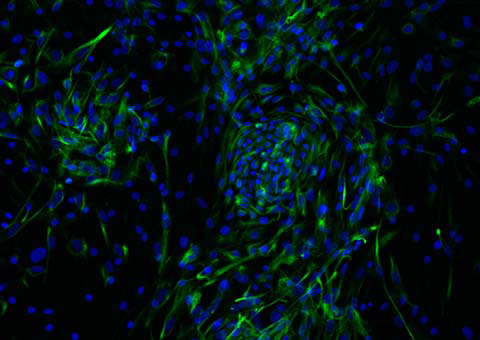 Beta cell differentiation image