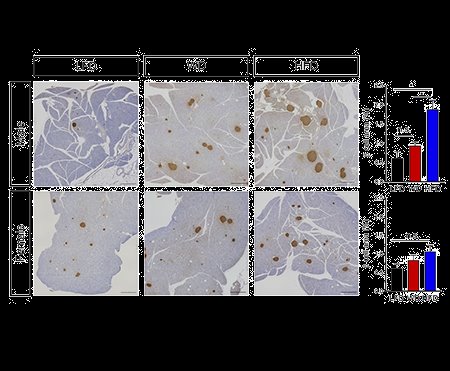 IBRI RESEARCH PUBLISHED: Phenotypic Sexual Dimorphism in Response to Dietary Fat Manipulation in C57BL/6J Mice
