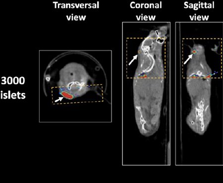 IBRI RESEARCH PUBLISHED: Beta Cell Imaging—From Pre-Clinical Validation to First in Man Testing
